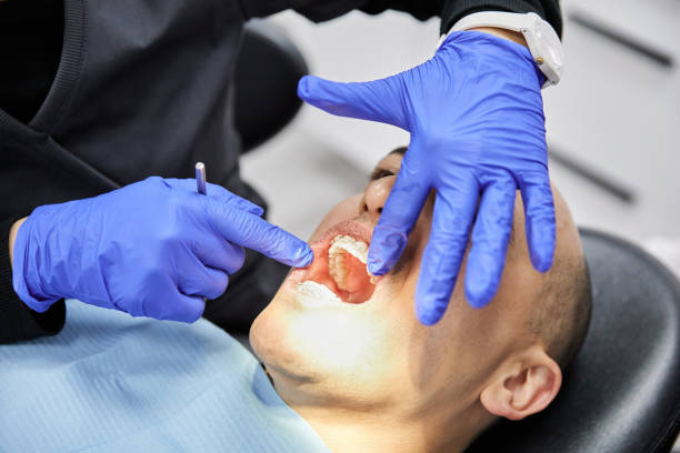 Best Emergency Dental Extractions in Dupont, WA